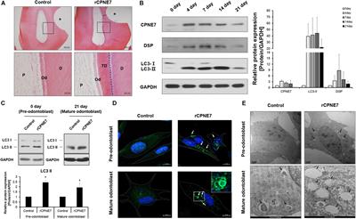 CPNE7-Induced Autophagy Restores the Physiological Function of Mature Odontoblasts